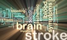brain stroke.jpg